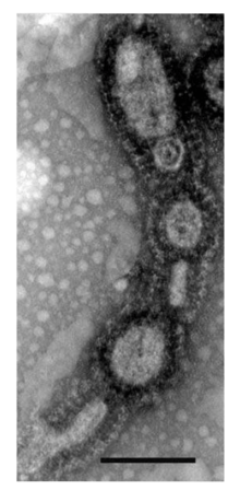 Transmission electron micrograph of A. boonei vesicles from culture (scale bar, 200nm)