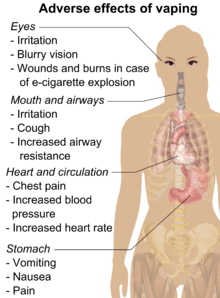 Adverse effects of vaping include throat irritation, cough, increased airway resistance, nausea, vomiting, chest pain, increased blood pressure, and increased heart rate.