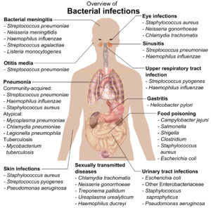 chart showing bacterial infections upon various parts of human body