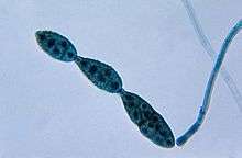 Chain of conidia of a Alternaria sp.