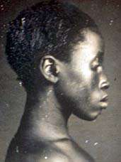 Daguerreotype of Delia, a slave woman on a plantation in Columbia, South Carolina. Delia was an American born slave, daughter of Congo born slave "Renty". (circa 1850-1853)