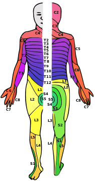 A person with dermatomes mapped out on the skin
