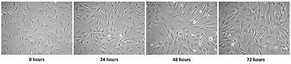Four micrographs, showing changes in cells over 72 hours