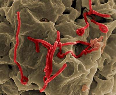 Ebola virus(Scanning electron mic)