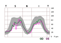 TSNIT graph