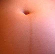 Linear, vertical brown patch inferior to umbilicus on the abdomen of a pregnant woman