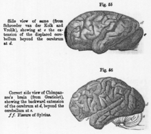 side views of two brains