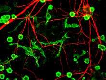 Microglia(green) interacting with neurons(red).