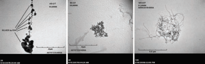 Three greyscale microscope images arranged horizontally.  The left two show agglomerations of black spots on a grey background, while the right one shows a mass of tangled fibers.