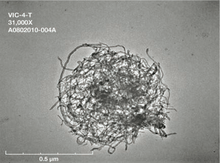 A microscope image of a ball made of agglomerated stringlike particles