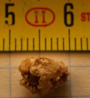 A color photograph of a kidney stone, 8&nbsp;millimetres in length.