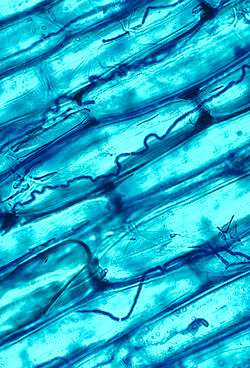 Fungal hyphae, blue-stained, among transparent plant cells.