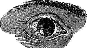 A black-and-white illustration of a mammalian right eye, with a lesion on the cornea overlying the lower-left portion of the iris, surrounded by enlarged blood vessels.