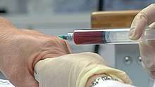 Platelet-rich plasma injections into the hand