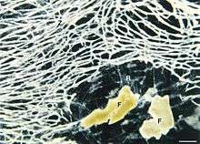 darkfield microscopic photo of the cell body (Z) of Reticulomyxa filosa. In the lower right of the picture you see some food particles (F) (wheat germ) surrounded by the fine stands of the Reticulopodial Network (R)