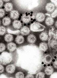 An electron micrograph of many rotavirus particles, two of which have several smaller, black spheres which appear to be attached to them