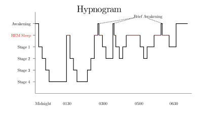 Hypnogram showing sleep cycles from midnight to morning.