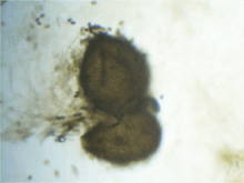 Sordaria fimicola perithecium magnified 40x