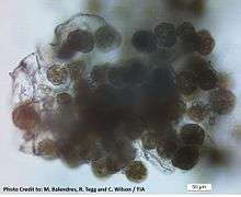 Sporosori (survival structure) of the powdery scab pathogen