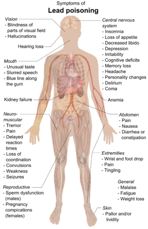 A chart of a human body with arrows pointing pieces of text to different parts of the body