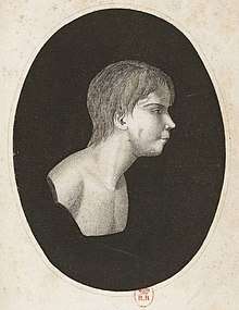 Oval head and shoulders side portrait of a boy without clothes. He has a medium length hair cut long at the neck, a receding chin, and gazes calmly ahead.