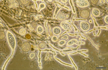 Hyphae (or germ tubes) and schizonts of Ichthyophonus hoferi