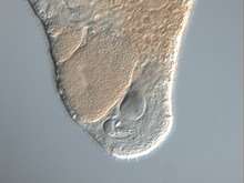 The needle-like stylet of Macrostomum hystrix. Further the seminal vesicle as well as developing eggs can be recognized.